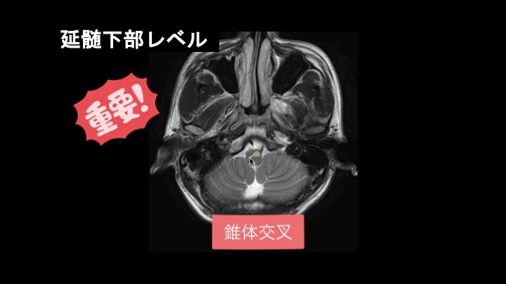 錐体外路系の解剖学